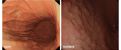 바로열쇠 이미지