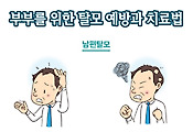 남편과 아내 모두를 위한 올바른 탈모 예방·치료법