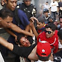 유혈 사태로 치닫은 베네수엘라 반정부 시위